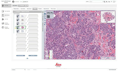 Leica--eSlide分析管理軟件.png