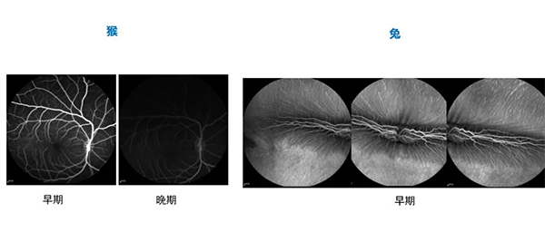 不同時期的眼底熒光造影（FA）.jpg