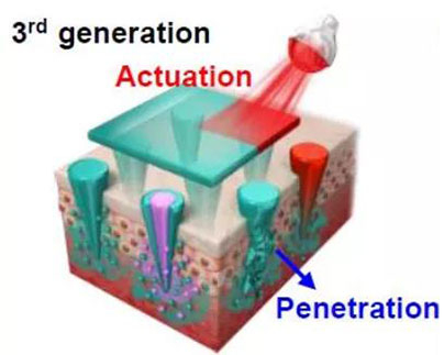 第三代：通過微針介導的皮膚層破壞和微針伴隨的各種功能增強藥物轉運.jpg