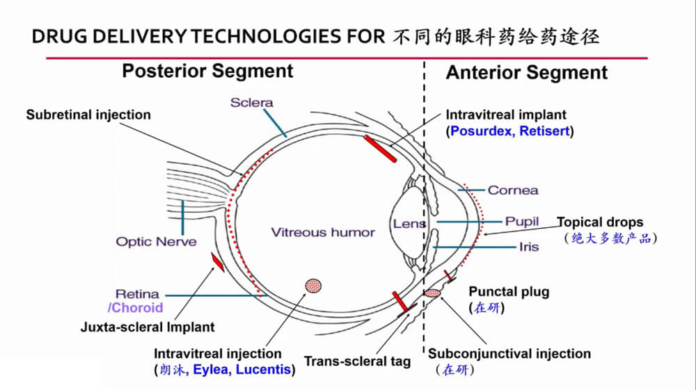 不同的眼科給藥途徑.jpg