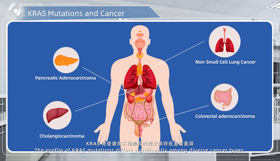 KRAS 突變與癌症的關係