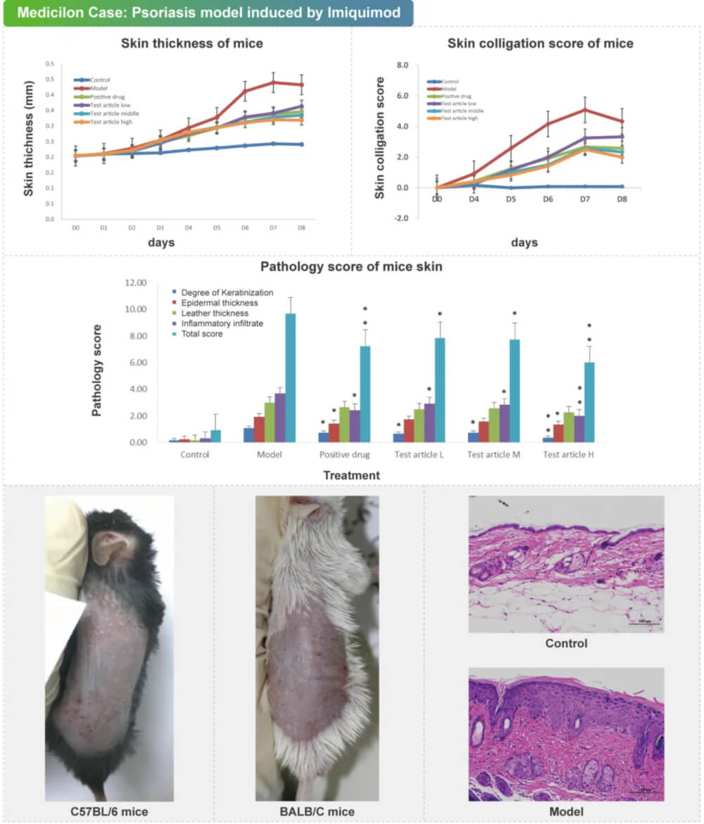 05 咪喹莫特誘導的銀屑病模型.jpg