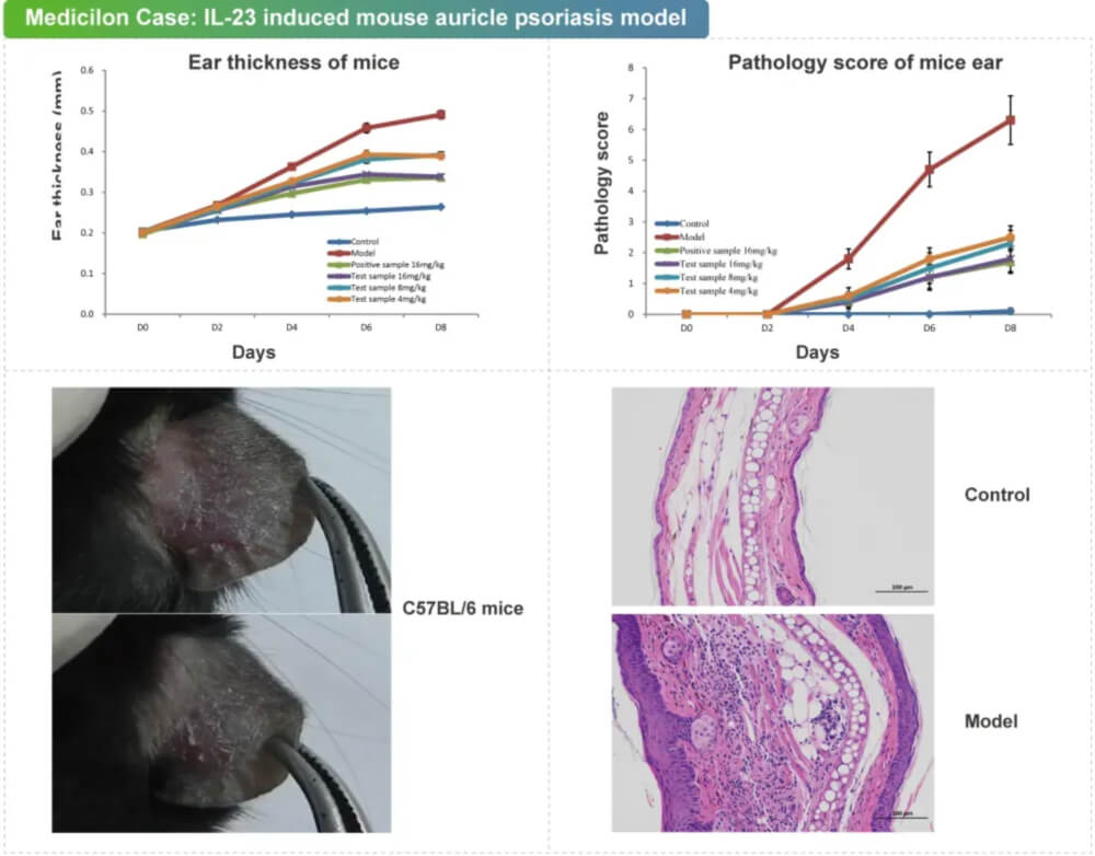 06 IL-23誘導的小鼠耳廓銀屑病模型.jpg